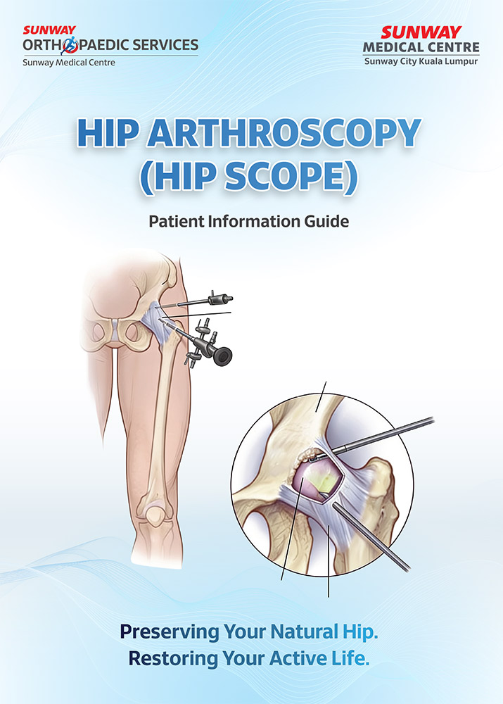 HIP Arthroscopy (HIP SCOPE)